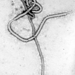 Immagine al microscopio elettronico del filovirus. I filamenti hanno un diametro di 60 - 80 nm. 